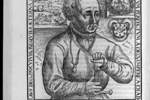 7 horribles casos de Homúnculos